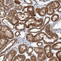LRRC47 Antibody, Novus Biologicals:Antibodies:Primary Antibodies