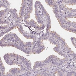 LRRC48 Antibody, Novus Biologicals:Antibodies:Primary Antibodies