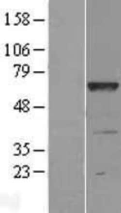 Novus Biologicals&trade;&nbsp;LRRC48 Overexpression Lysate