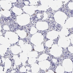 LRRC58 Antibody, Novus Biologicals:Antibodies:Primary Antibodies