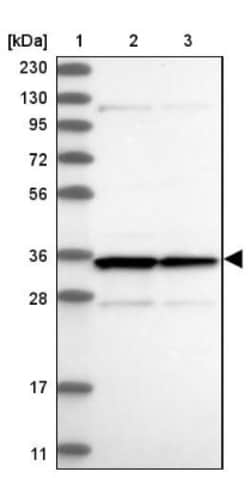 LRRC59 Antibody, Novus Biologicals 0.1mL; Unlabeled:Antibodies, Polyclonal