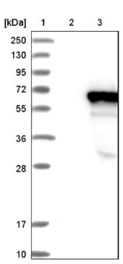 LRRC6 Antibody, Novus Biologicals 25 &mu;L | Buy Online | Novus Biologicals | Fisher Scientific