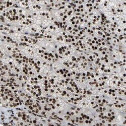 LRRC61 Antibody, Novus Biologicals:Antibodies:Primary Antibodies