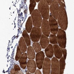LRRC63 Antibody, Novus Biologicals:Antibodies:Primary Antibodies