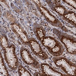 LRRC63 Antibody, Novus Biologicals 0.1mL; Unlabeled:Antibodies, Polyclonal