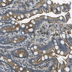 LRRC66 Antibody, Novus Biologicals:Antibodies:Primary Antibodies