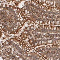 LRRC67 Antibody, Novus Biologicals:Antibodies:Primary Antibodies