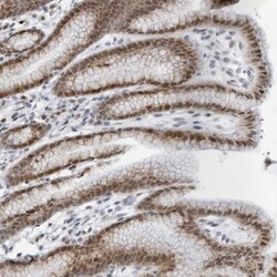 LRRC67 Antibody, Novus Biologicals 0.1mL; Unlabeled:Antibodies, Polyclonal