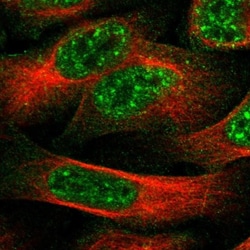 LRRC72 Antibody, Novus Biologicals 0.1mL; Unlabeled:Antibodies, Polyclonal