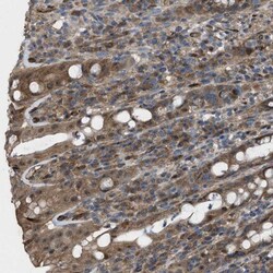 LRRC72 Antibody, Novus Biologicals 0.1mL; Unlabeled:Antibodies, Polyclonal