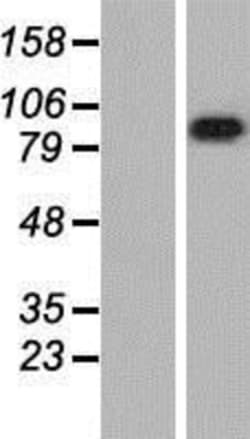 Novus Biologicals&trade;&nbsp;LRRC8A Overexpression Lysate