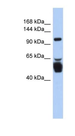 LRRC8B Antibody, Novus Biologicals 100 &mu;L | Buy Online | Novus Biologicals | Fisher Scientific