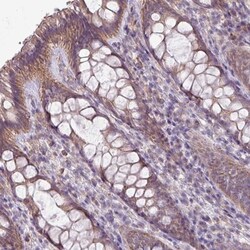 LRRC9 Antibody, Novus Biologicals:Antibodies:Primary Antibodies