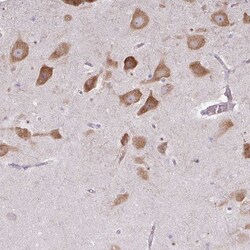 LRRC9 Antibody, Novus Biologicals:Antibodies:Primary Antibodies