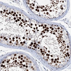 LRRFIP2 Antibody, Novus Biologicals 25 &mu;L; Unlabeled:Antibodies, Polyclonal