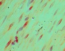 LRRFIP2 Antibody, Novus Biologicals:Antibodies:Primary Antibodies
