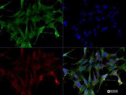 LRRK2 Antibody - BSA Free, Novus Biologicals 0.1mL; Unlabeled:Antibodies,