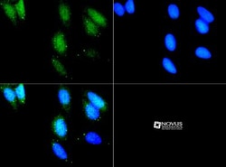 LRRK2 Antibody - BSA Free, Novus Biologicals 0.025mL; Unlabeled:Antibodies,