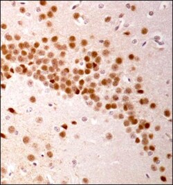 LRRK2 Antibody - BSA Free, Novus Biologicals 0.025mL; Unlabeled:Antibodies,