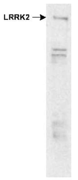 LRRK2 Antibody - BSA Free, Novus Biologicals 0.1mL; Unlabeled:Antibodies,