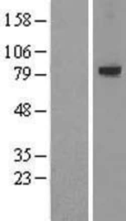Novus Biologicals&trade;&nbsp;LRRN1/NLRR-1 Overexpression Lysate