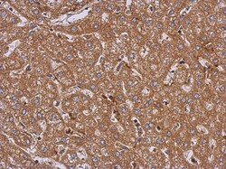 LRRN2 Antibody, Novus Biologicals 0.1mL; Unlabeled:Antibodies, Polyclonal