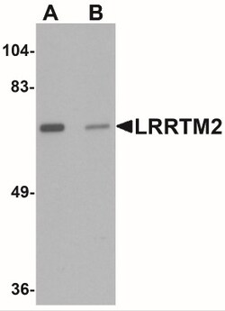 LRRTM2 Antibody - BSA Free, Novus Biologicals 0.025 mg, Unlabeled:Antibodies,
