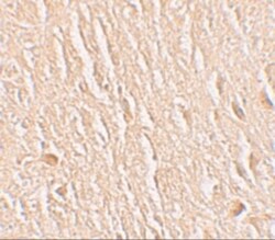 LRRTM3 Antibody - BSA Free, Novus Biologicals 0.025 mg, Unconjugated:Antibodies,