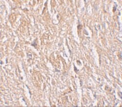LRRTM4 Antibody - BSA Free, Novus Biologicals 0.1mg; Unlabeled:Antibodies,