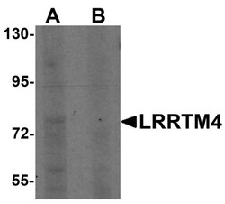 LRRTM4 Antibody - BSA Free, Novus Biologicals 0.1mg; Unlabeled:Antibodies,