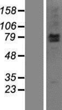 Novus Biologicals&trade;&nbsp;LRSAM1 Overexpression Lysate