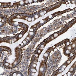 LRSAM1 Antibody, Novus Biologicals 0.1mL; Unlabeled:Antibodies, Polyclonal
