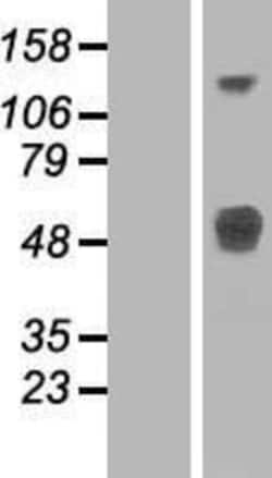 Novus Biologicals LRTM1 Overexpression Lysate 0.1 mg | Buy Online | Novus Biologicals&trade; | Fisher Scientific