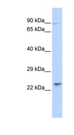 LRTOMT Antibody, Novus Biologicals 100 &mu;L | Buy Online | Novus Biologicals | Fisher Scientific