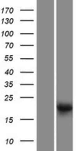 Novus Biologicals&trade;&nbsp;LRTOMT Overexpression Lysate