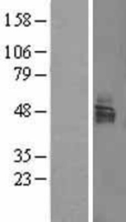Novus Biologicals&trade;&nbsp;LAMP Overexpression Lysate