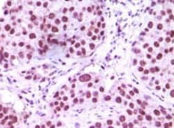 LSD1 Antibody (1B2E5), Novus Biologicals:Antibodies:Primary Antibodies