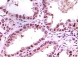 LSD1 Antibody (1B2E5), Novus Biologicals:Antibodies:Primary Antibodies