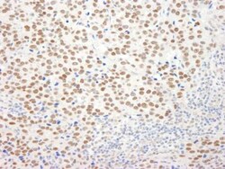 LSD1 Antibody, Novus Biologicals 0.1mg; Unlabeled:Antibodies, Polyclonal