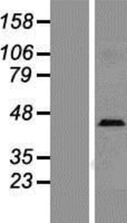 Novus Biologicals&trade;&nbsp;L-Selectin/CD62L Overexpression Lysate