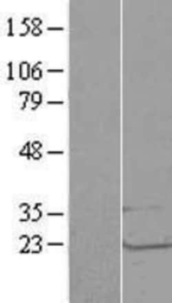 Novus Biologicals LSM1 Overexpression Lysate 0.1 mg | Buy Online | Novus Biologicals&trade; | Fisher Scientific