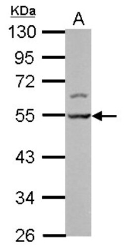 LSM11 Antibody, Novus Biologicals 0.1mL; Unlabeled:Antibodies, Polyclonal