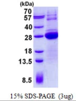 Novus Biologicals Recombinant Human LSM12 His Protein 0.02 mg | Buy Online | Novus Biologicals&trade; | Fisher Scientific
