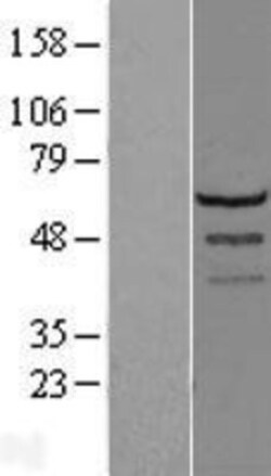 Novus Biologicals&trade;&nbsp;LSM14A Overexpression Lysate