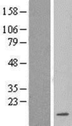 Novus Biologicals&trade;&nbsp;LSM3 Overexpression Lysate
