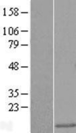 Novus Biologicals™ LSM5 Overexpression Lysate