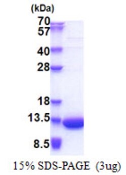 Novus Biologicals&trade;&nbsp;Recombinant Human LSM5 His Protein