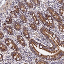 LSM5 Antibody, Novus Biologicals 0.1mL; Unlabeled:Antibodies, Polyclonal