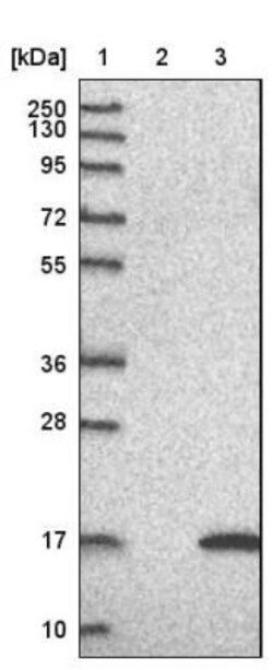 LSM5 Antibody, Novus Biologicals 0.1mL; Unlabeled:Antibodies, Polyclonal