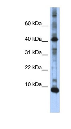 LSM6 Antibody, Novus Biologicals 20&mu;L; Unlabeled:Antibodies, Polyclonal